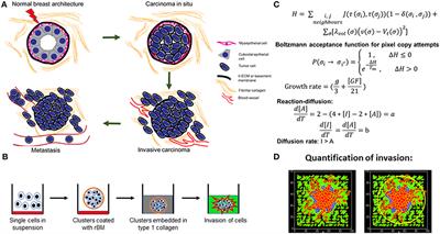 An Interplay Between Reaction-Diffusion and Cell-Matrix Adhesion Regulates Multiscale Invasion in Early Breast Carcinomatosis
